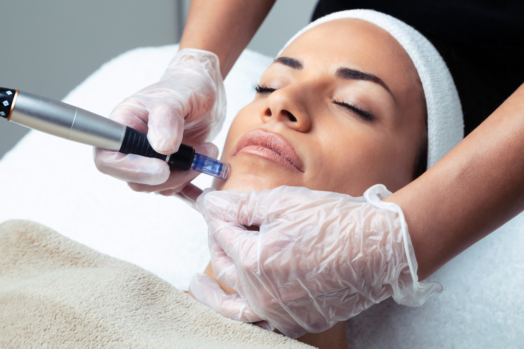 How Long Does Microneedling Take to Heal