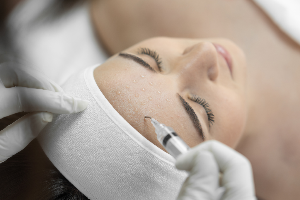 How to Remove Dead Skin After Microneedling: A Comprehensive Guide